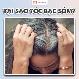 tai sao toc bac som 1