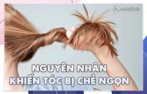 Tóc chẻ ngọn là gì? Nguyên nhân và cách khắc phục